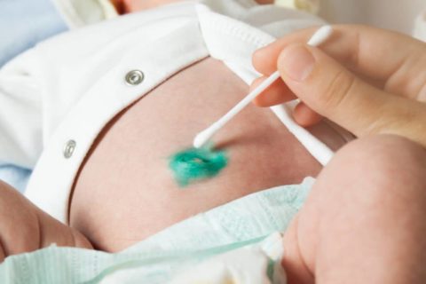 Entzündeter Bauchnabel beim Baby